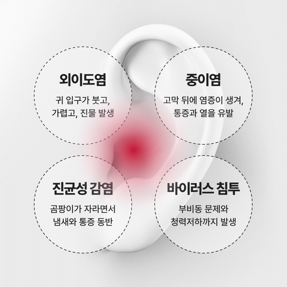 편안한 잠을 위한 소음 차단 귀마개 추천! 군인도 사용하는 실리콘 이어플러그