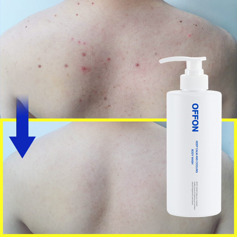 등드름 걱정 끝! 자연 성분으로 피부를 깨끗하게 지켜주는 바디워시 추천